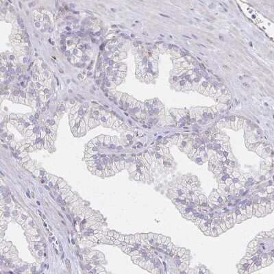 Immunohistochemistry-Paraffin: Sodium Potassium ATPase Alpha 3 Antibody [NBP2-37955]