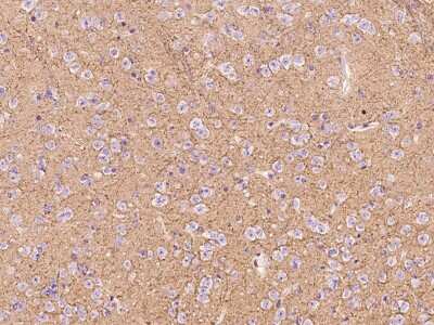 Immunohistochemistry-Paraffin: Sodium Potassium ATPase Alpha 3 Antibody [NBP2-99238]