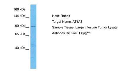 Western Blot: Sodium Potassium ATPase Alpha 3 Antibody [NBP2-88330]