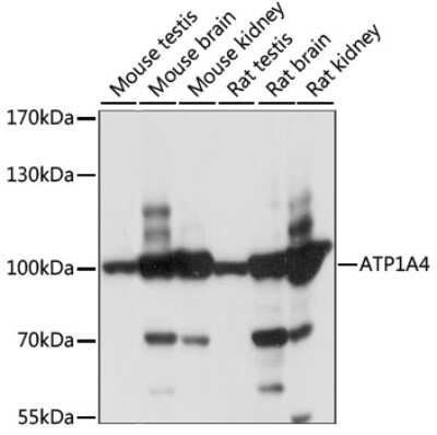 Western Blot: Sodium Potassium ATPase Alpha 4 AntibodyAzide and BSA Free [NBP2-94614]