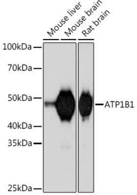 Western Blot: Sodium Potassium ATPase Beta 1 Antibody (4M5T3) [NBP3-16560]