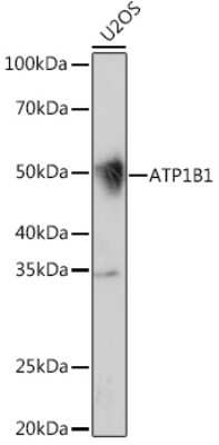 Sodium Potassium ATPase Beta 1 Antibody (4M5T3) (NBP3-16560) by Novus ...