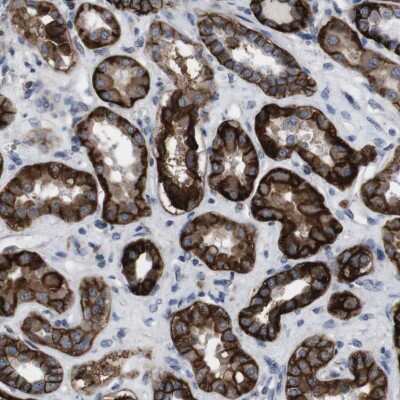 Immunohistochemistry-Paraffin: Sodium Potassium ATPase Beta 1 Antibody [NBP2-54665]