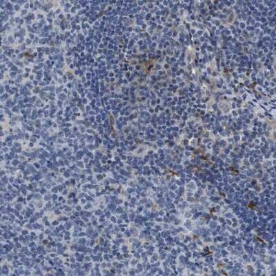 Immunohistochemistry-Paraffin: Sodium Potassium ATPase Beta 1 Antibody [NBP2-54665]