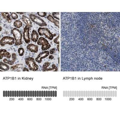 Immunohistochemistry-Paraffin: Sodium Potassium ATPase Beta 1 Antibody [NBP2-54665]