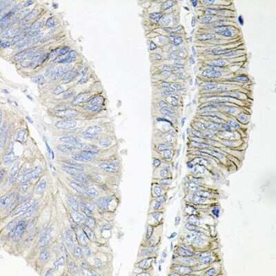 Immunohistochemistry-Paraffin: Sodium Potassium ATPase Beta 1 Antibody - BSA Free [NBP2-95093]