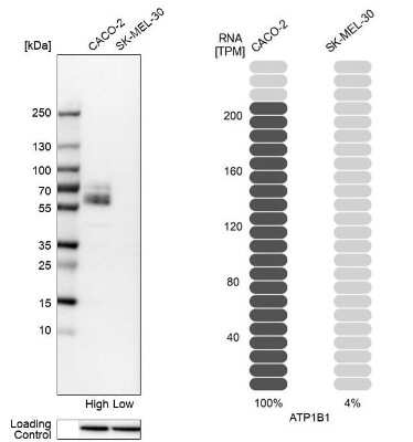 Western Blot: Sodium Potassium ATPase Beta 1 Antibody [NBP2-54665]