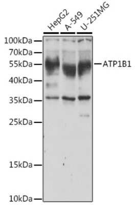 Western Blot: Sodium Potassium ATPase Beta 1 AntibodyBSA Free [NBP2-95093]