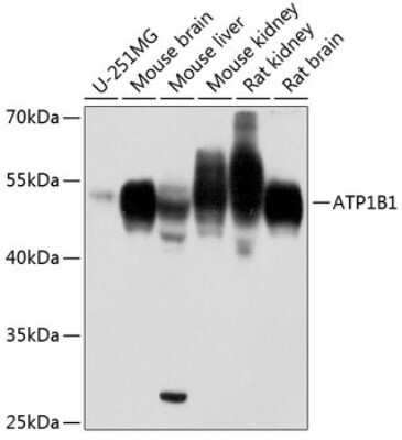 Western Blot: Sodium Potassium ATPase Beta 1 AntibodyAzide and BSA Free [NBP2-95095]