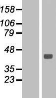 Western Blot: Sodium Potassium ATPase Beta 1 Overexpression Lysate [NBL1-07811]