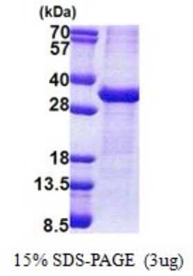 SDS-PAGE: Recombinant Human Sodium Potassium ATPase Beta 1 His Protein [NBP2-53034]