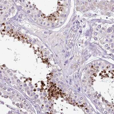 Immunohistochemistry: Soggy-1/DkkL1 Antibody [NBP2-48868]