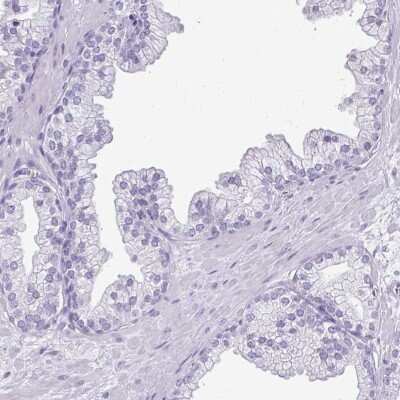Immunohistochemistry-Paraffin: Soggy-1/DkkL1 Antibody [NBP2-48868]
