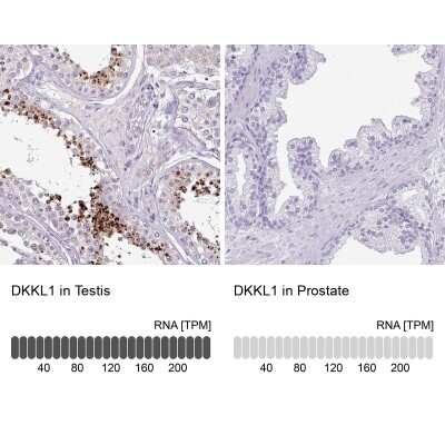 Immunocytochemistry/ Immunofluorescence: Soggy-1/DkkL1 Antibody [NBP2-48868]