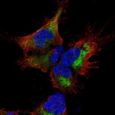 Immunocytochemistry/ Immunofluorescence: Solo Antibody [NBP2-68737]