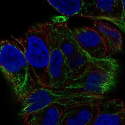 Immunocytochemistry/ Immunofluorescence: Solo Antibody [NBP2-69038]