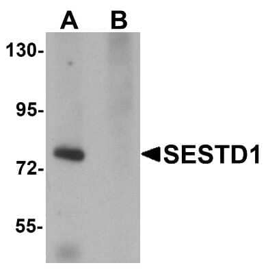 Western Blot: Solo AntibodyBSA Free [NBP1-76279]