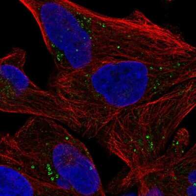 Immunocytochemistry/ Immunofluorescence: Soluble Liver/Pancreas Antigen Antibody [NBP2-57464]