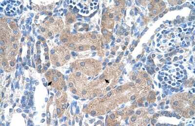 Immunohistochemistry-Paraffin: Soluble Liver/Pancreas Antigen Antibody [NBP1-57253]