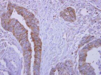 Immunohistochemistry-Paraffin: Soluble Liver/Pancreas Antigen Antibody [NBP2-20454]