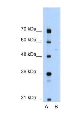 Western Blot: Soluble Liver/Pancreas Antigen Antibody [NBP1-57253]