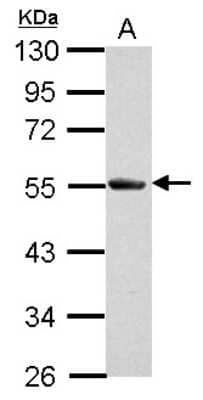 Western Blot: Soluble Liver/Pancreas Antigen Antibody [NBP2-20454]