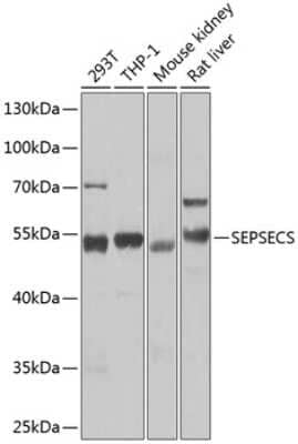 Western Blot: Soluble Liver/Pancreas Antigen AntibodyBSA Free [NBP2-94530]