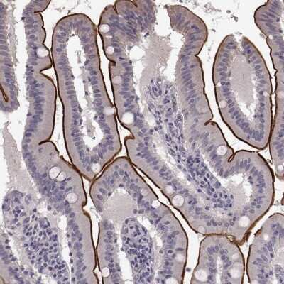 Immunohistochemistry-Paraffin: Solute carrier family 22 member 18 Antibody [NBP2-56316]