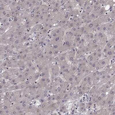 Immunohistochemistry-Paraffin: Solute carrier family 22 member 18 Antibody [NBP2-57503]