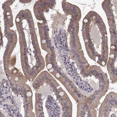 Immunohistochemistry-Paraffin: Solute carrier family 22 member 18 Antibody [NBP2-57503]