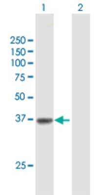 Western Blot: Solute carrier family 22 member 18 Antibody [H00005002-B01P]