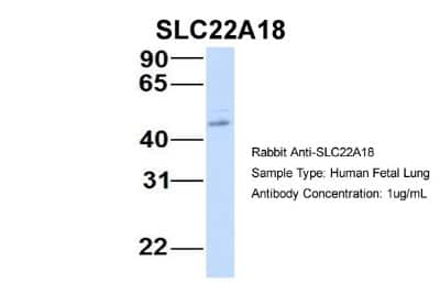 Western Blot: Solute carrier family 22 member 18 Antibody [NBP1-59747]