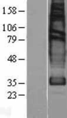 Western Blot: Solute carrier family 22 member 18 Overexpression Lysate [NBP2-04446]