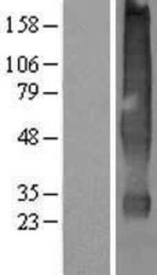 Western Blot: Solute carrier family 22 member 18 Overexpression Lysate [NBP2-10836]