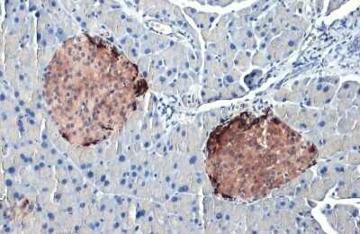 Immunohistochemistry-Paraffin: Somatostatin Antibody (HL1101) [NBP3-13719]