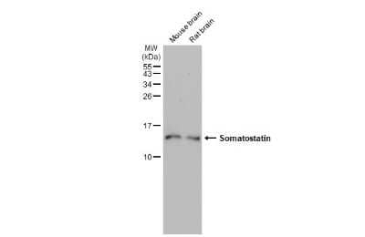 Western Blot: Somatostatin Antibody (HL1101) [NBP3-13719]