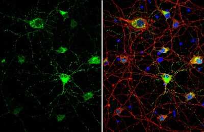 Immunocytochemistry/ Immunofluorescence: Somatostatin Antibody [NBP3-13160]