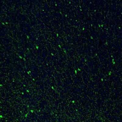 Immunohistochemistry: Somatostatin Antibody [NBP1-87022]
