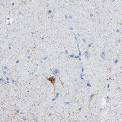 Immunohistochemistry-Paraffin: Somatostatin Antibody [NBP1-87022]