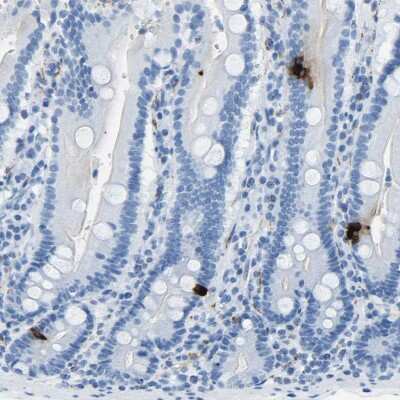 Immunohistochemistry-Paraffin: Somatostatin Antibody [NBP1-87022]