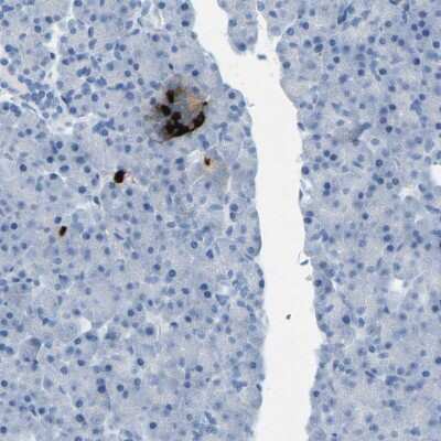 Immunohistochemistry-Paraffin: Somatostatin Antibody [NBP1-87022]