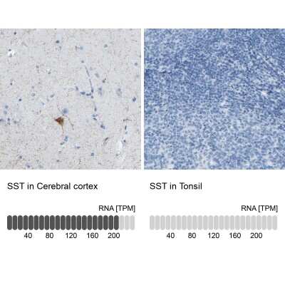 Immunohistochemistry-Paraffin: Somatostatin Antibody [NBP1-87022]