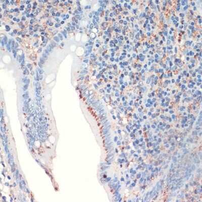 Immunohistochemistry-Paraffin: Somatostatin Antibody - Azide and BSA Free [NBP2-93171]