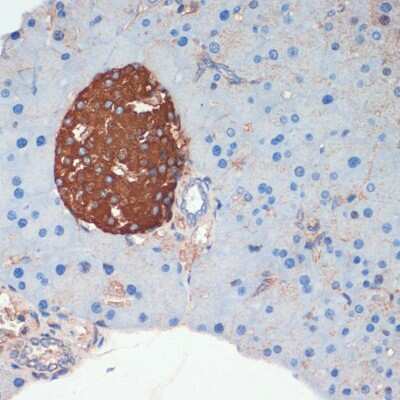 Immunohistochemistry-Paraffin: Somatostatin Antibody - Azide and BSA Free [NBP2-93171]