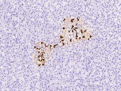 Immunohistochemistry-Paraffin: Somatostatin Antibody [NBP2-99309]