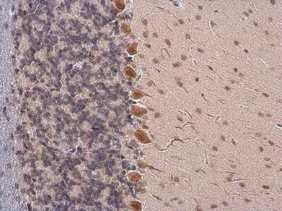 Immunohistochemistry-Paraffin: Somatostatin Antibody [NBP3-13160]