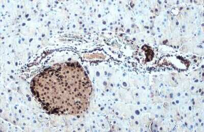 Immunohistochemistry-Paraffin: Somatostatin Antibody [NBP3-13160]