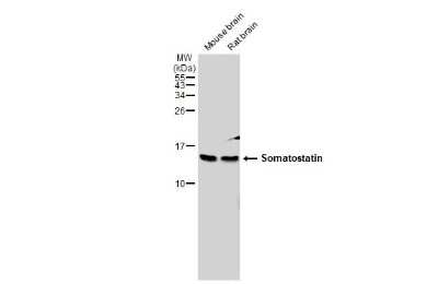 Western Blot: Somatostatin Antibody [NBP3-13160]