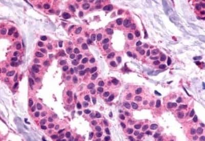 Immunohistochemistry: Somatostatin R1/SSTR1 Antibody [NBP3-14480]