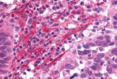 Immunohistochemistry: Somatostatin R1/SSTR1 Antibody [NBP3-14480]